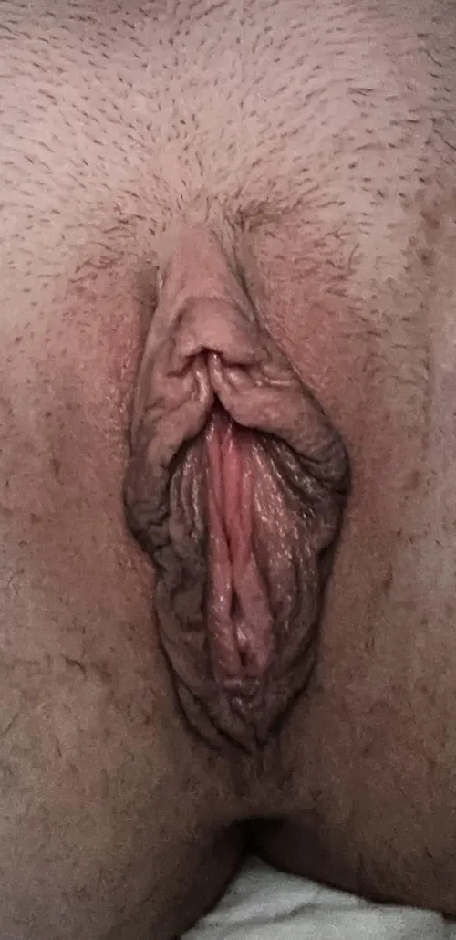 This labia needs relief 