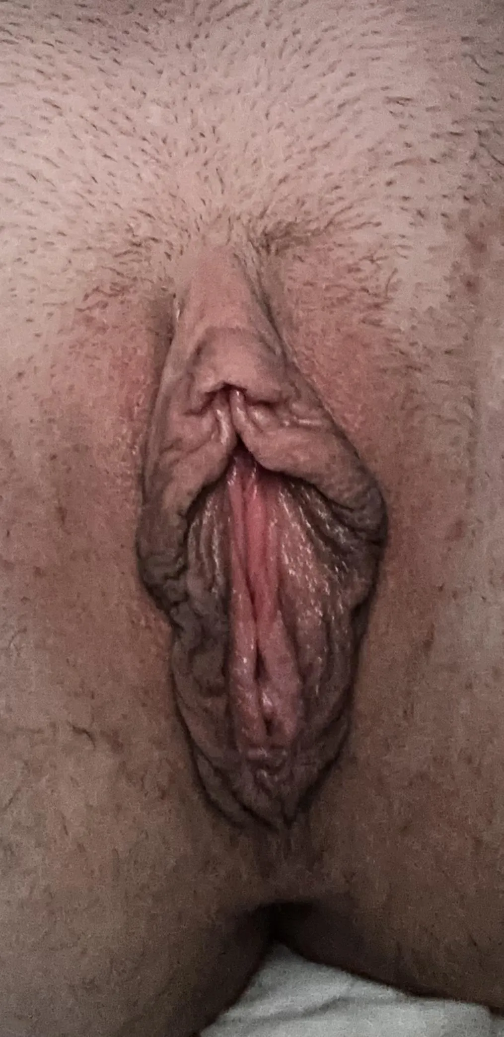 This labia needs relief 