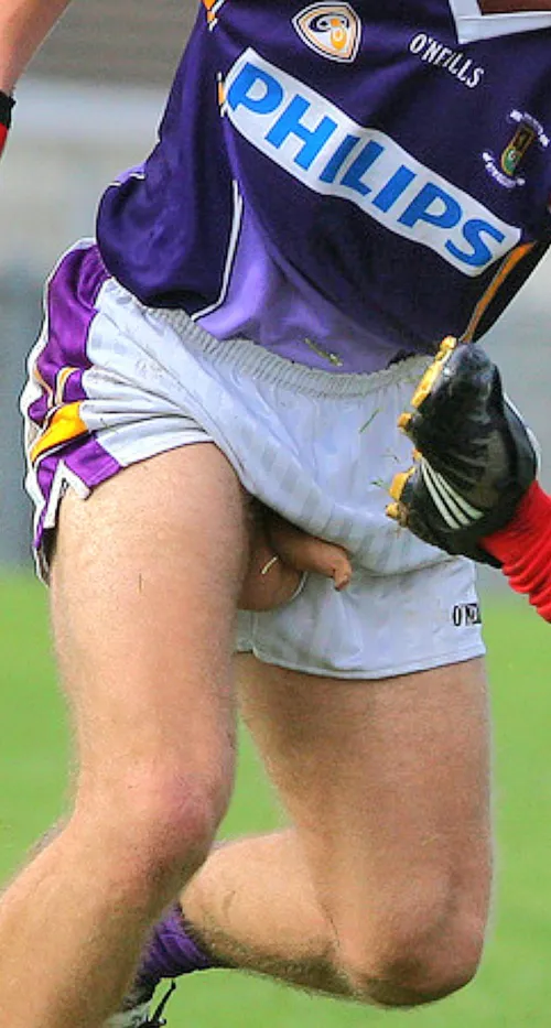 A close-up of a Scottish footballer, with a very long foreskin.
