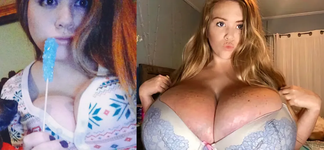 Macromastia at its best