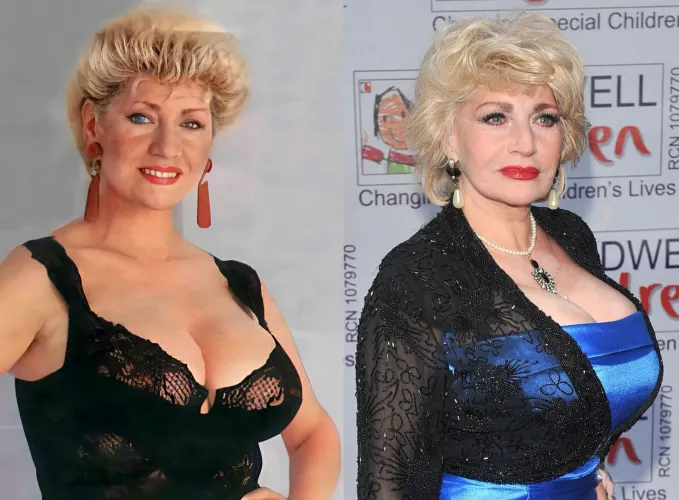 They can keep growing way past your 20s