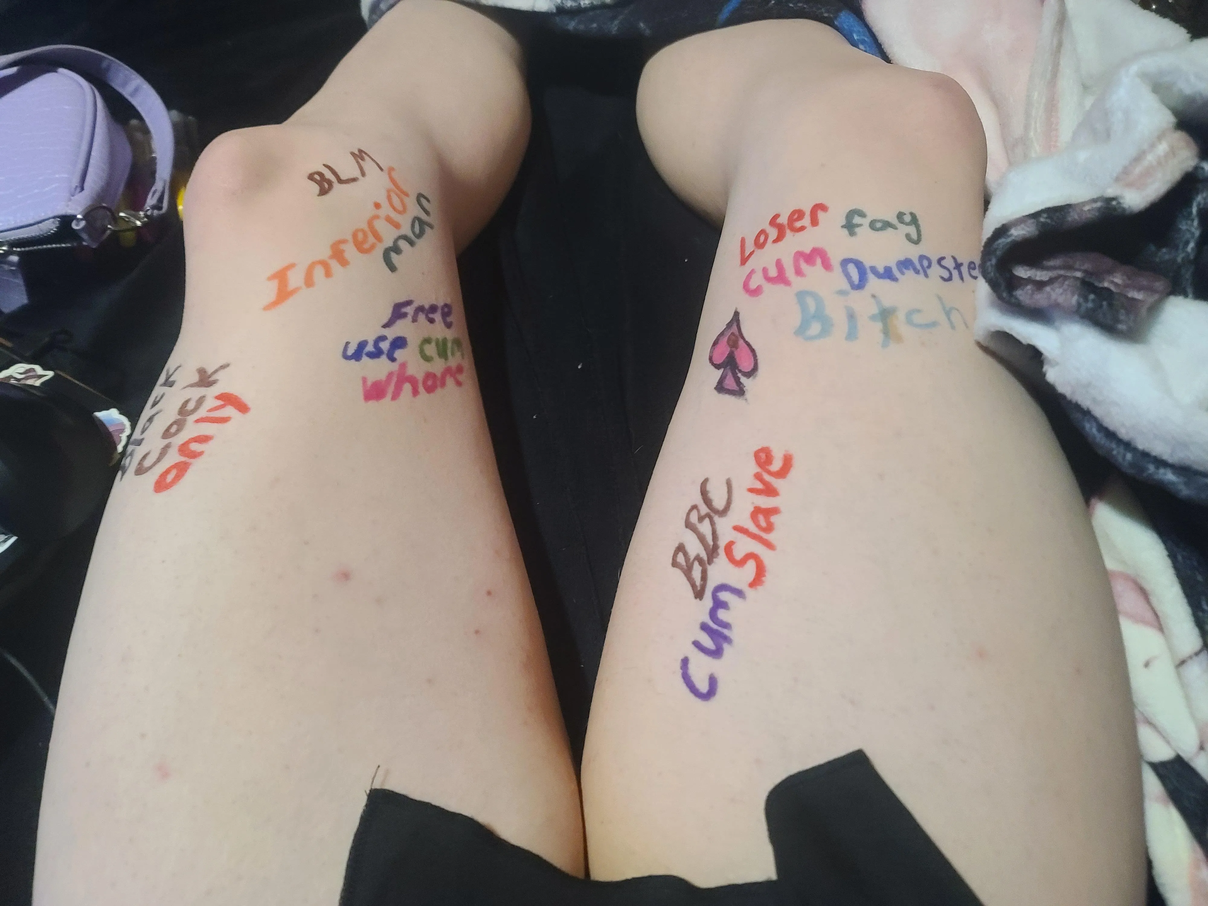 Any other suggestions?