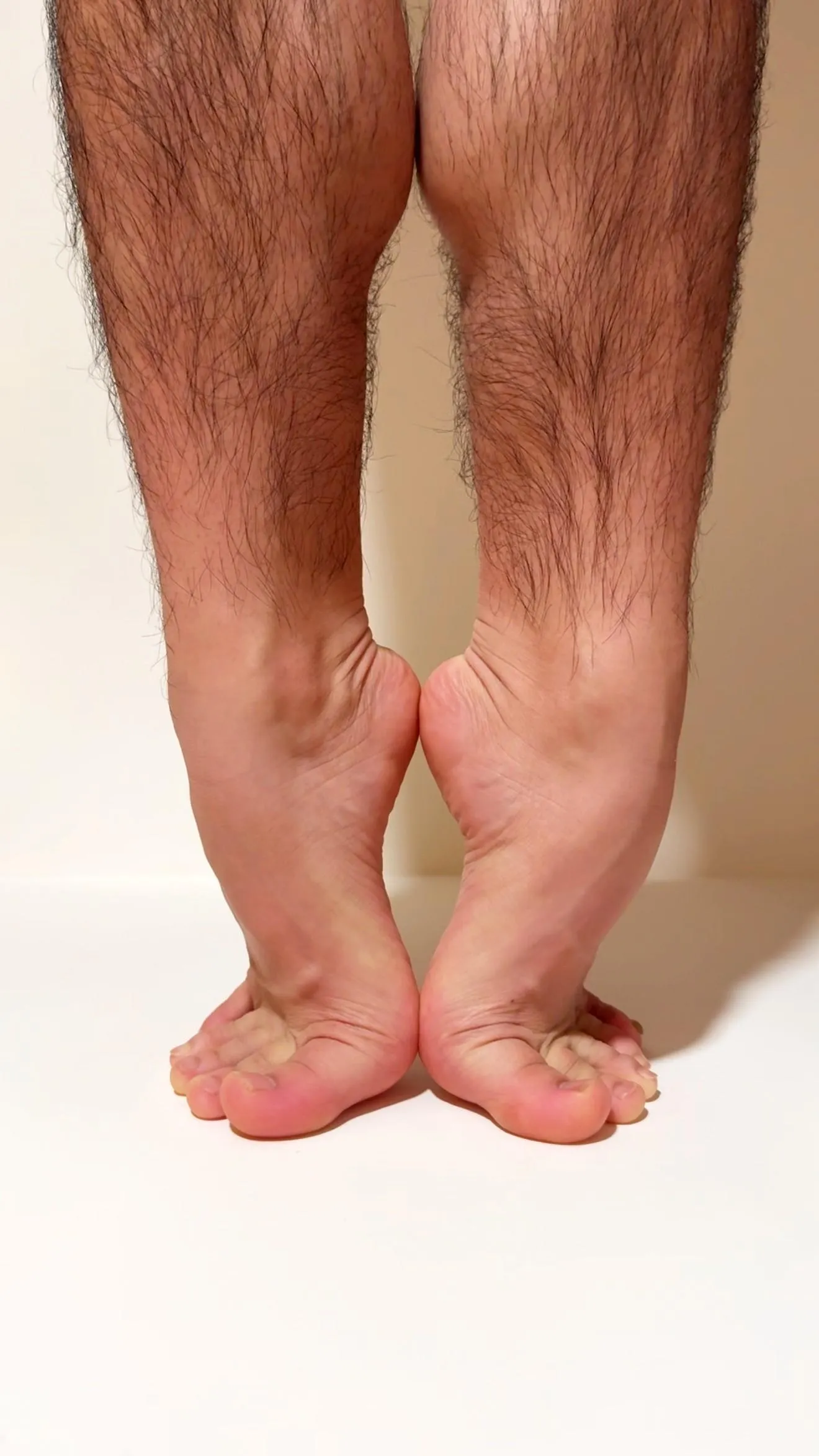 First post! I've been shamed for my insanely dark and thick leg hair in ballet class... Have I found my people here in this subreddit? 