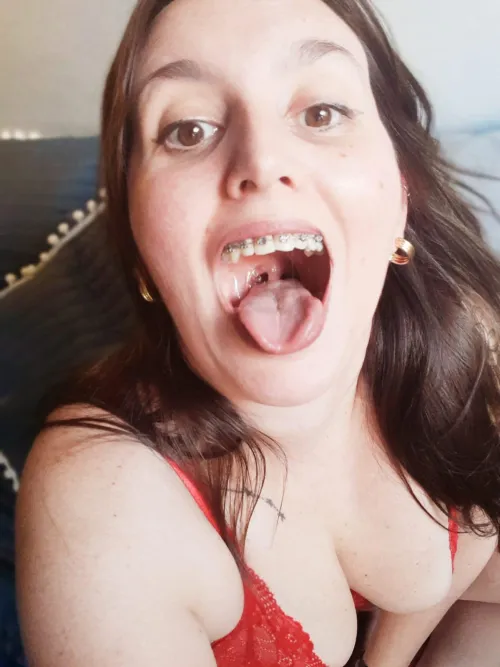 Look, yesterday I did my braces check. Don't they look incredible?