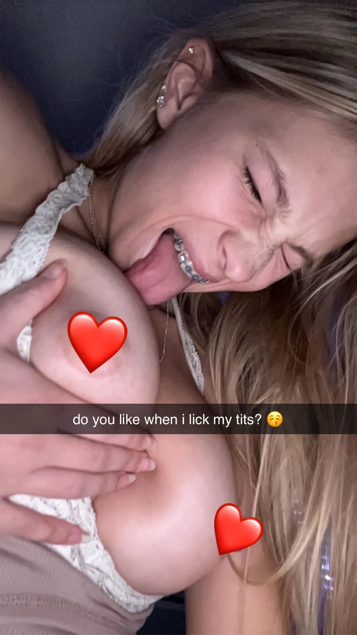 my braces or boobs, i need to know!