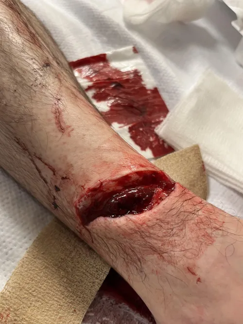 Steel Roofing is Sharp