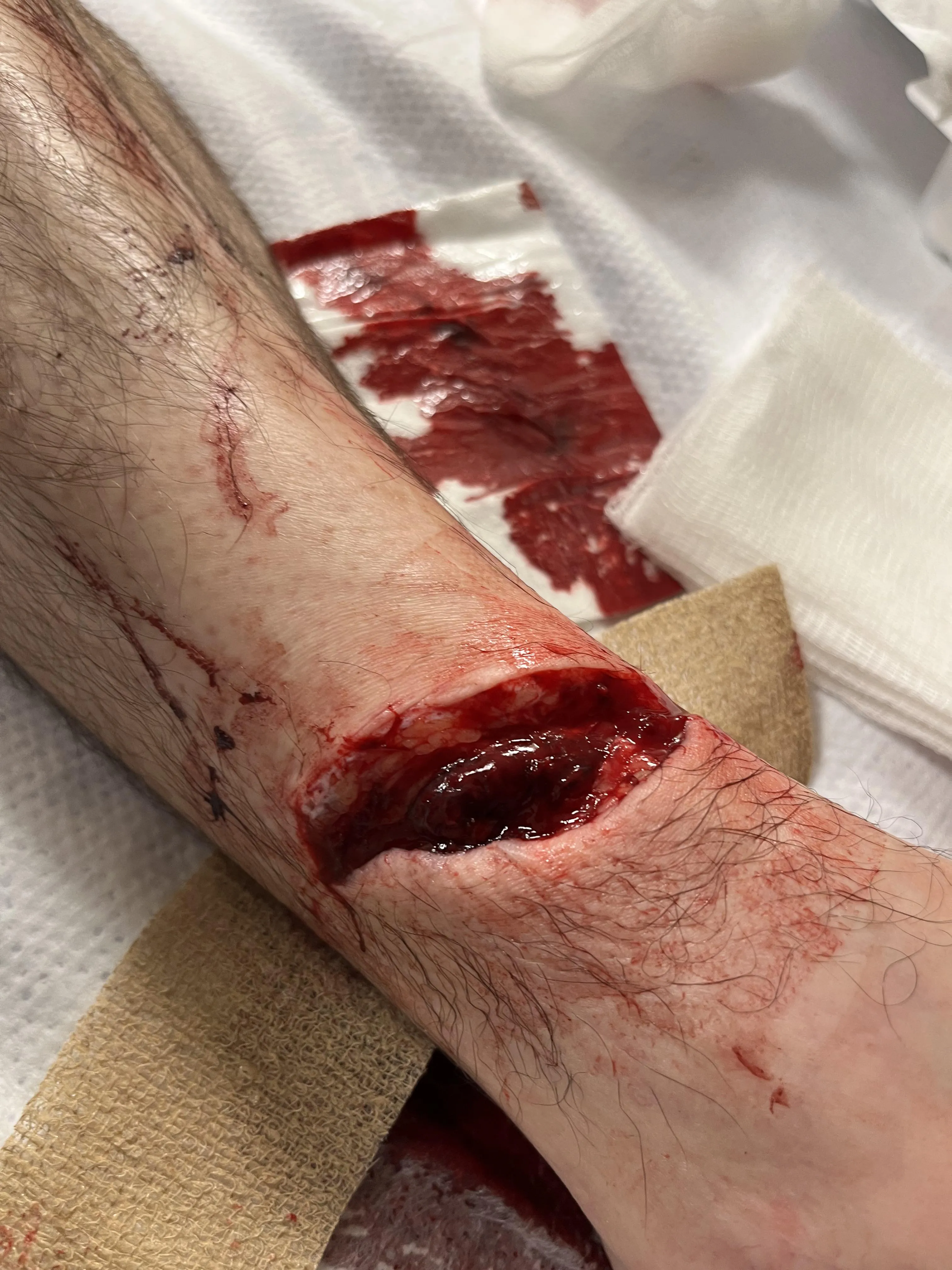 Steel Roofing is Sharp