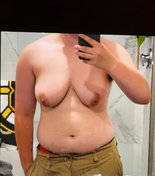 Found a pic B4 surgery, thoughts?