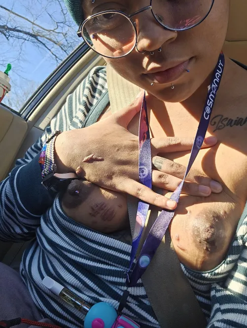 It's so orgasmic scratching my scars mmmm