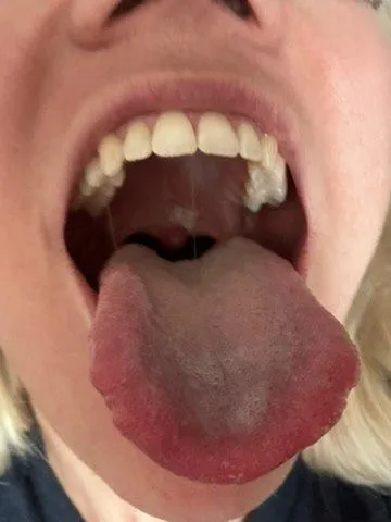 my tongue will drive you crazy