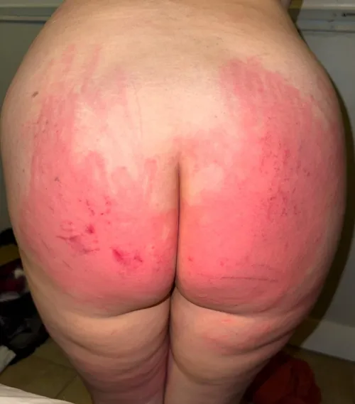 This hurts so bad…