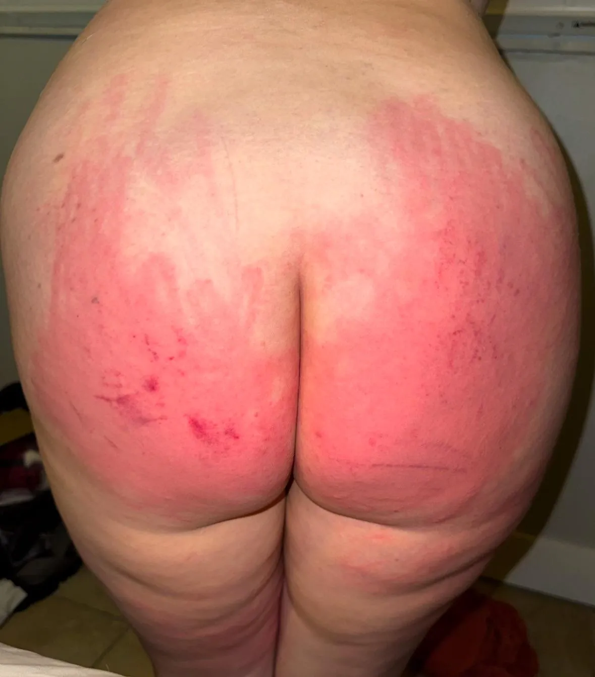 This hurts so bad…