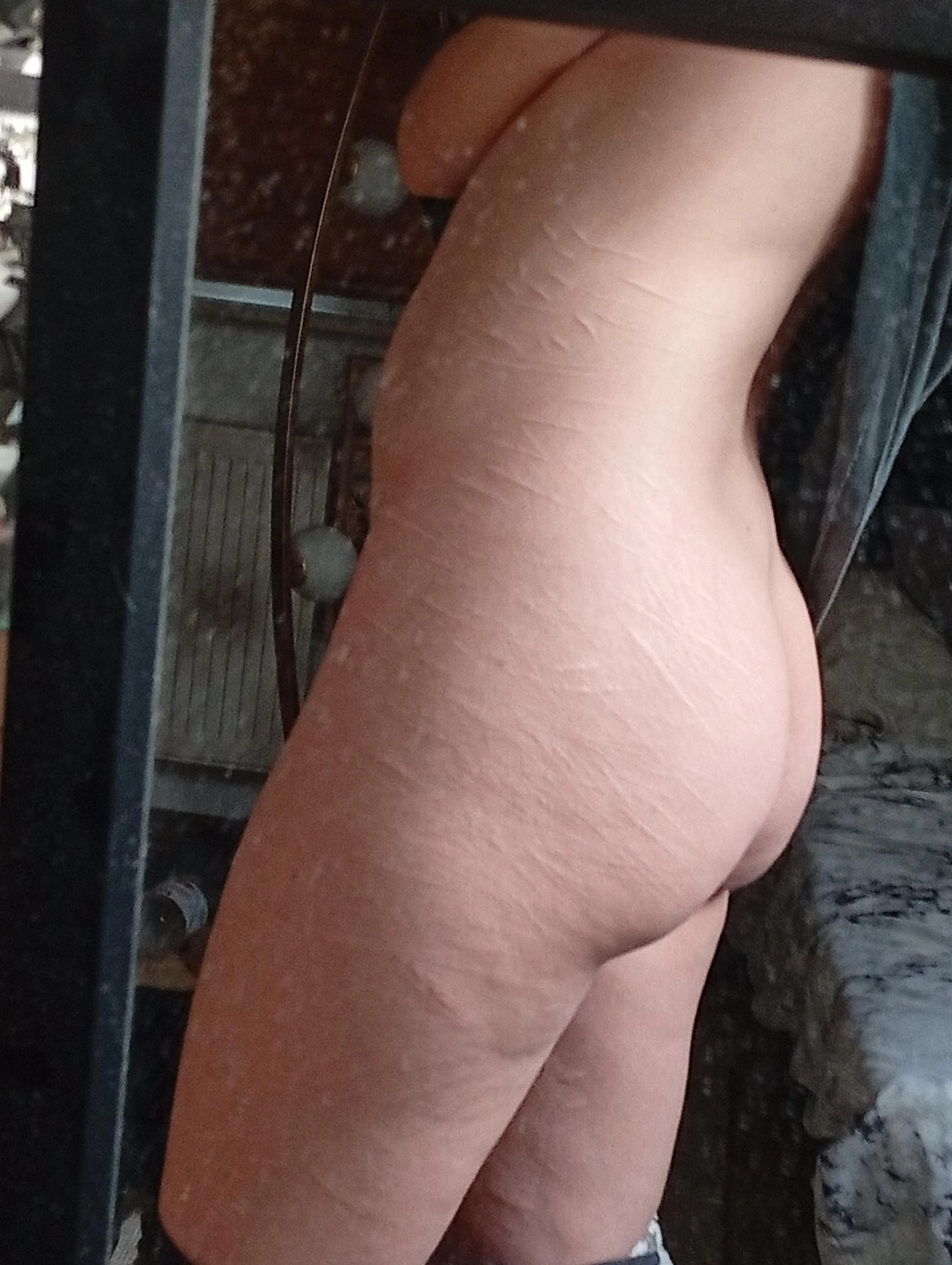 You really see the scars on this pic