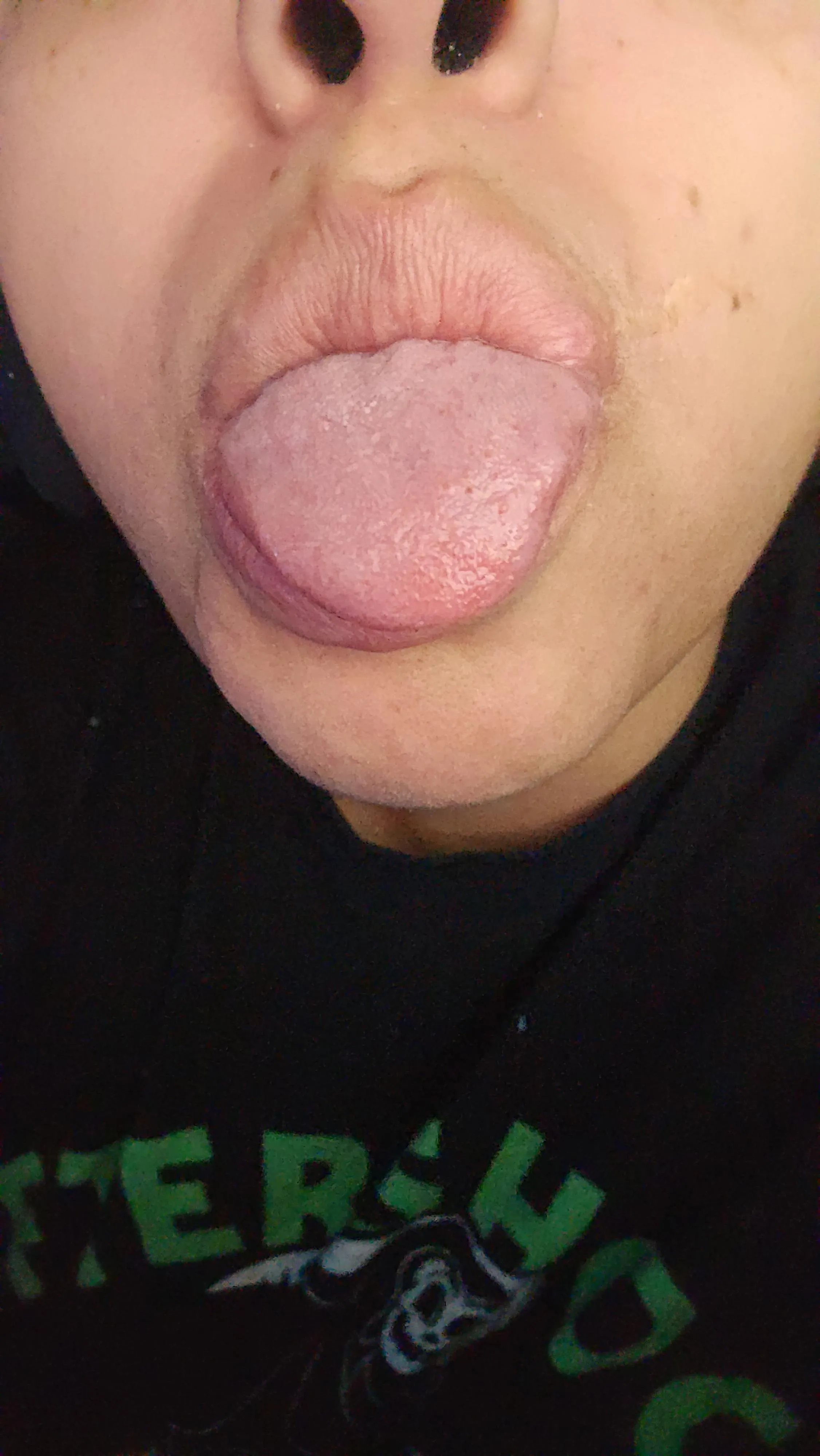 Small dots on tongue and not much taste