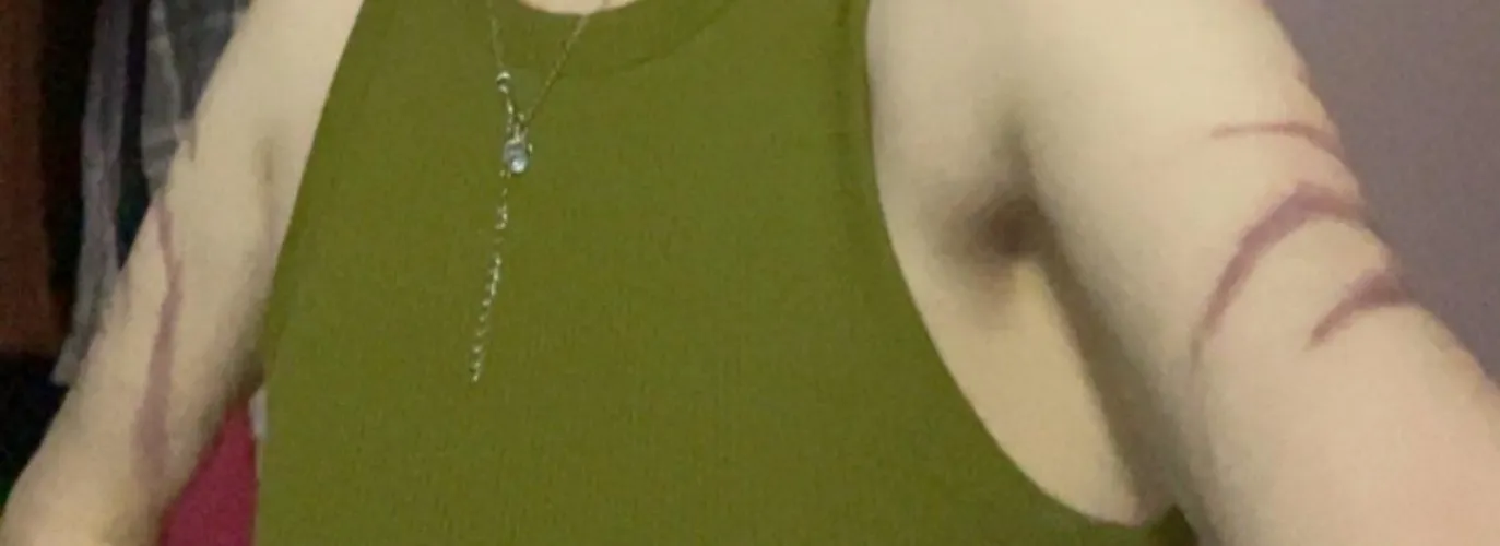 Do you like my scars?