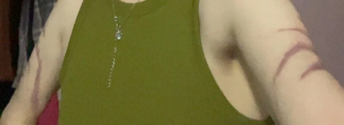 Do you like my scars?