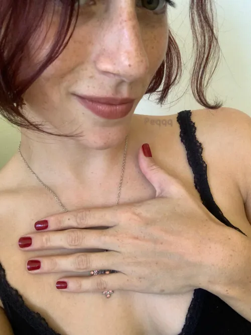 I just have too many freckles and moles