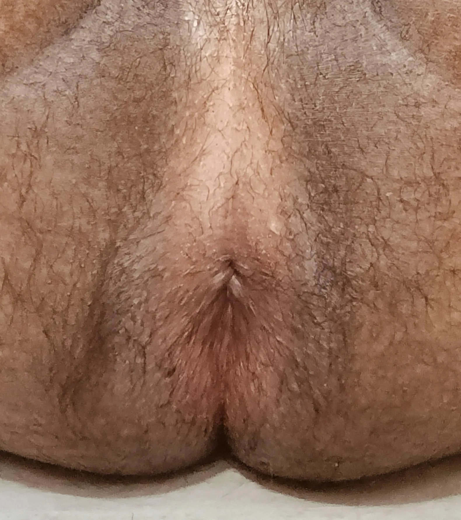 18 M Indian From the US. DMs Open.