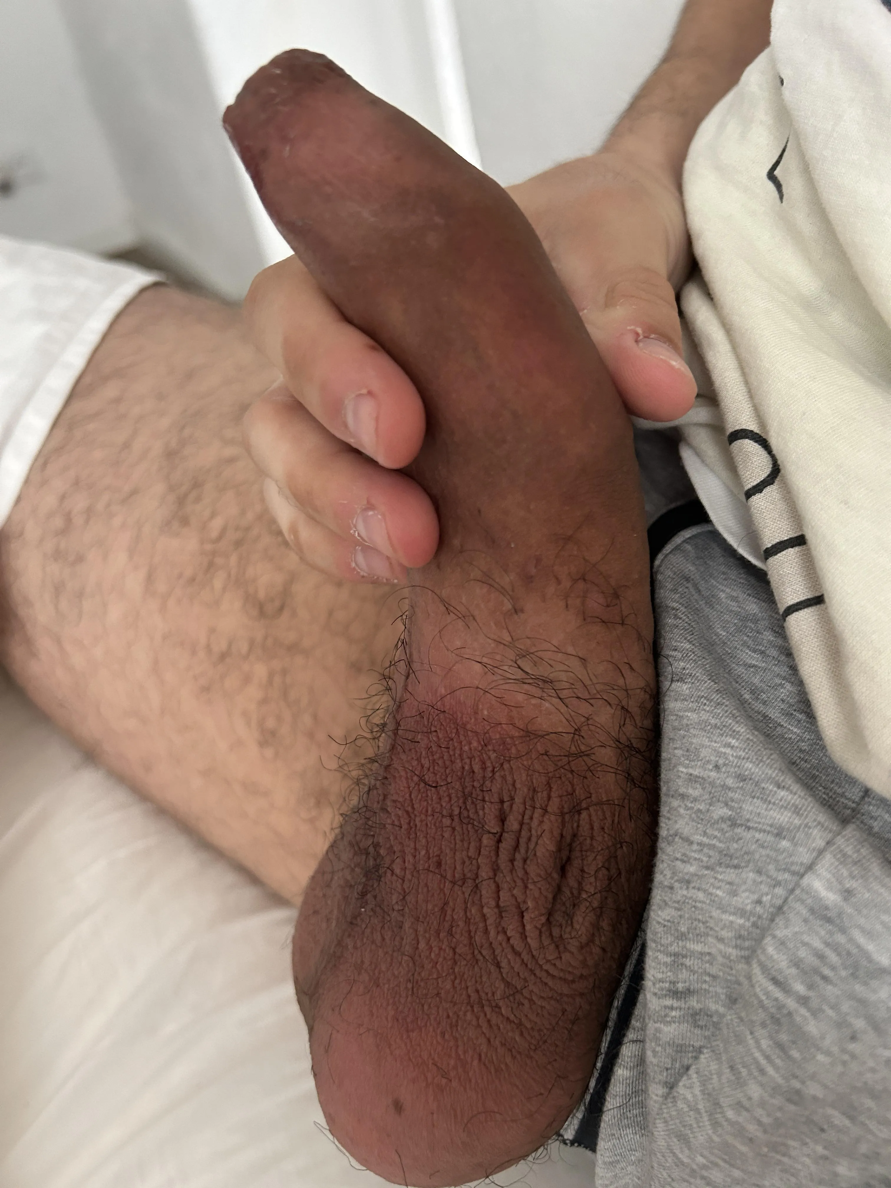 [29] French foreskin