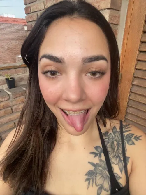 Can I be ur teenage braceface