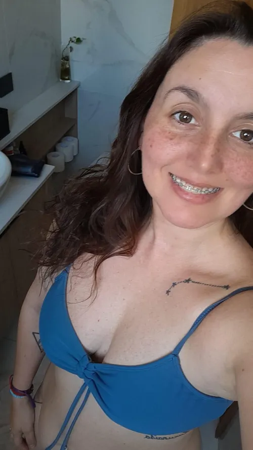 Hello My Loves, look at these braces