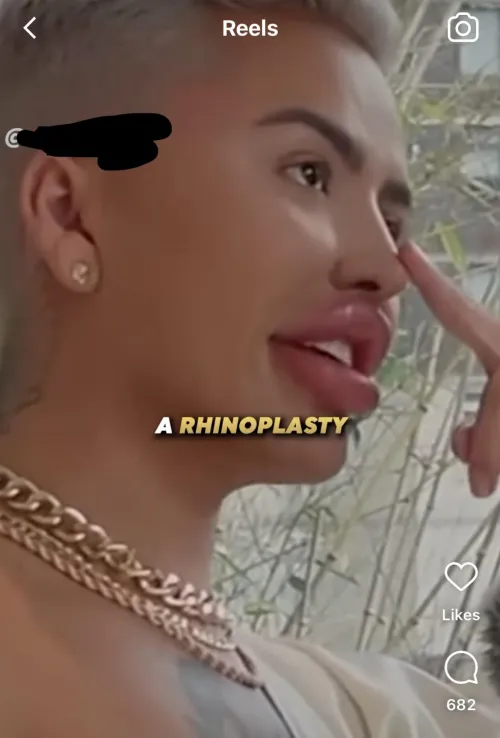 Listing off the work he's had done and needless to say, it's a lot 