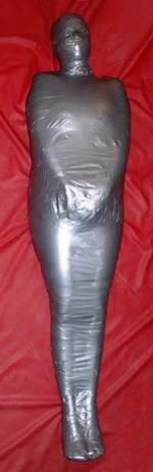 Tiffany Trans gurl in London UK - First stage - next comes the plaster of paris