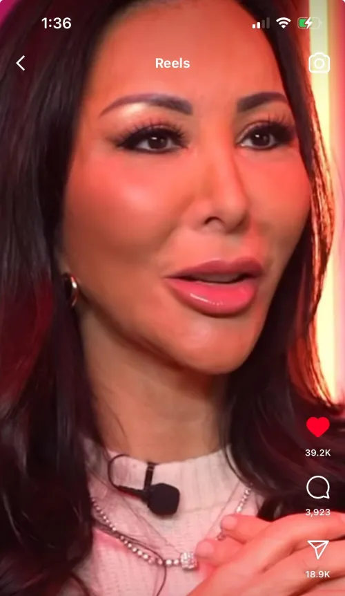 “We no longer want to look filled, we no longer want to look fake”