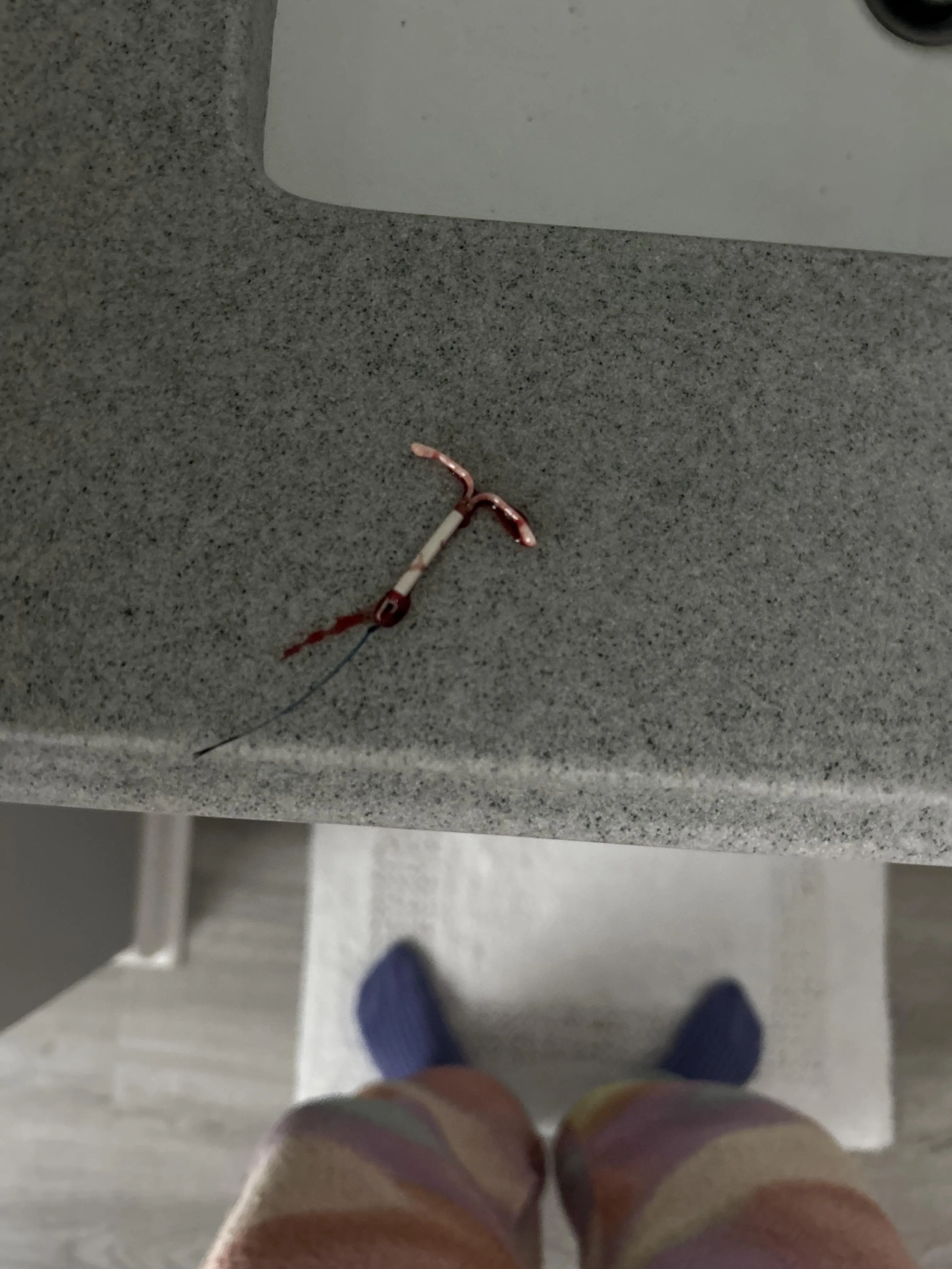 iud slipped out
