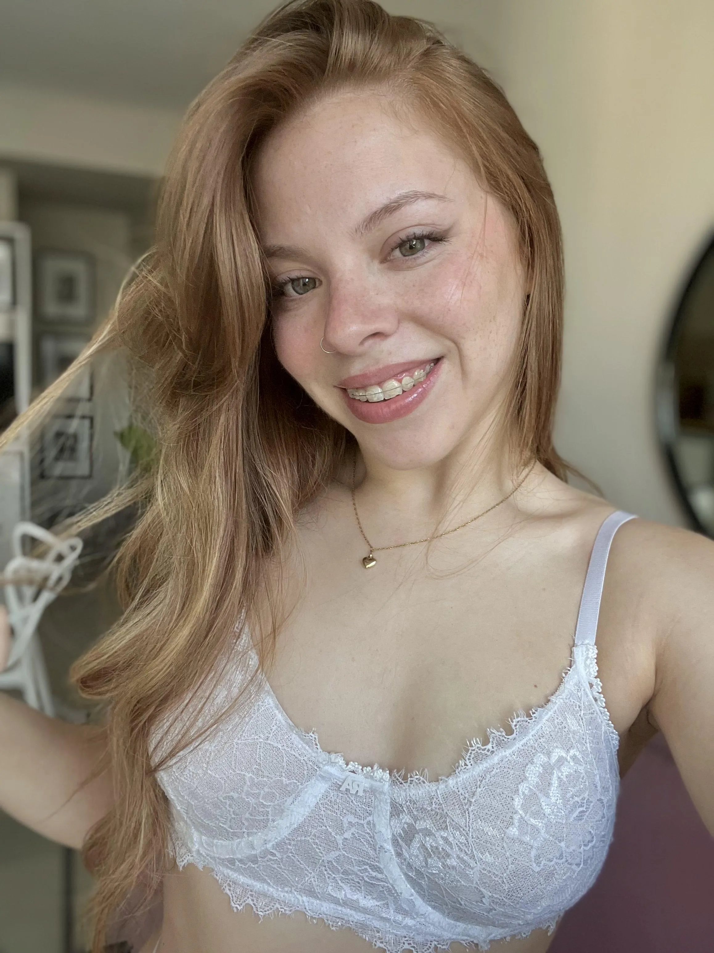 Do the braces make me more attractive