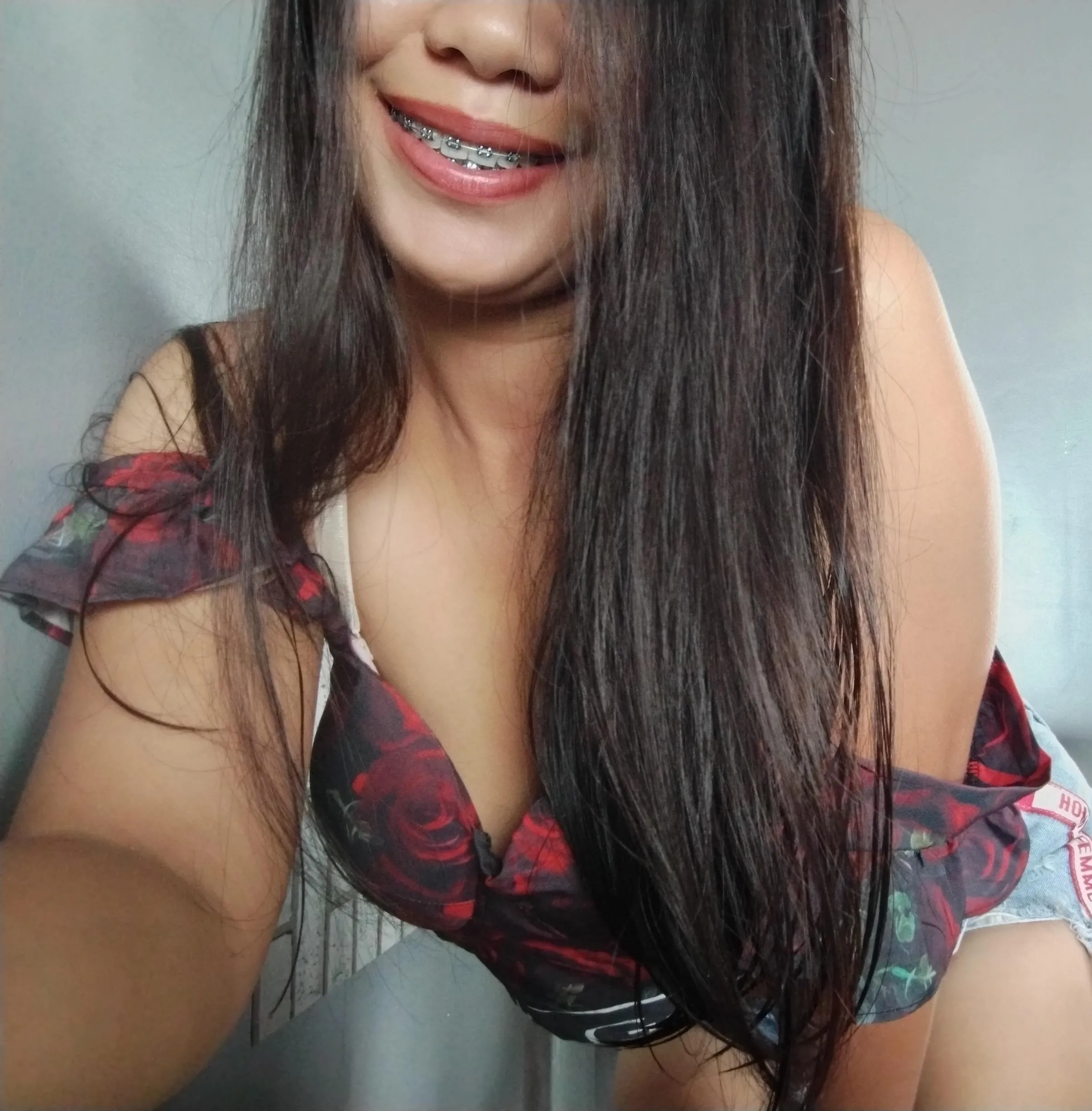 twerking with braces