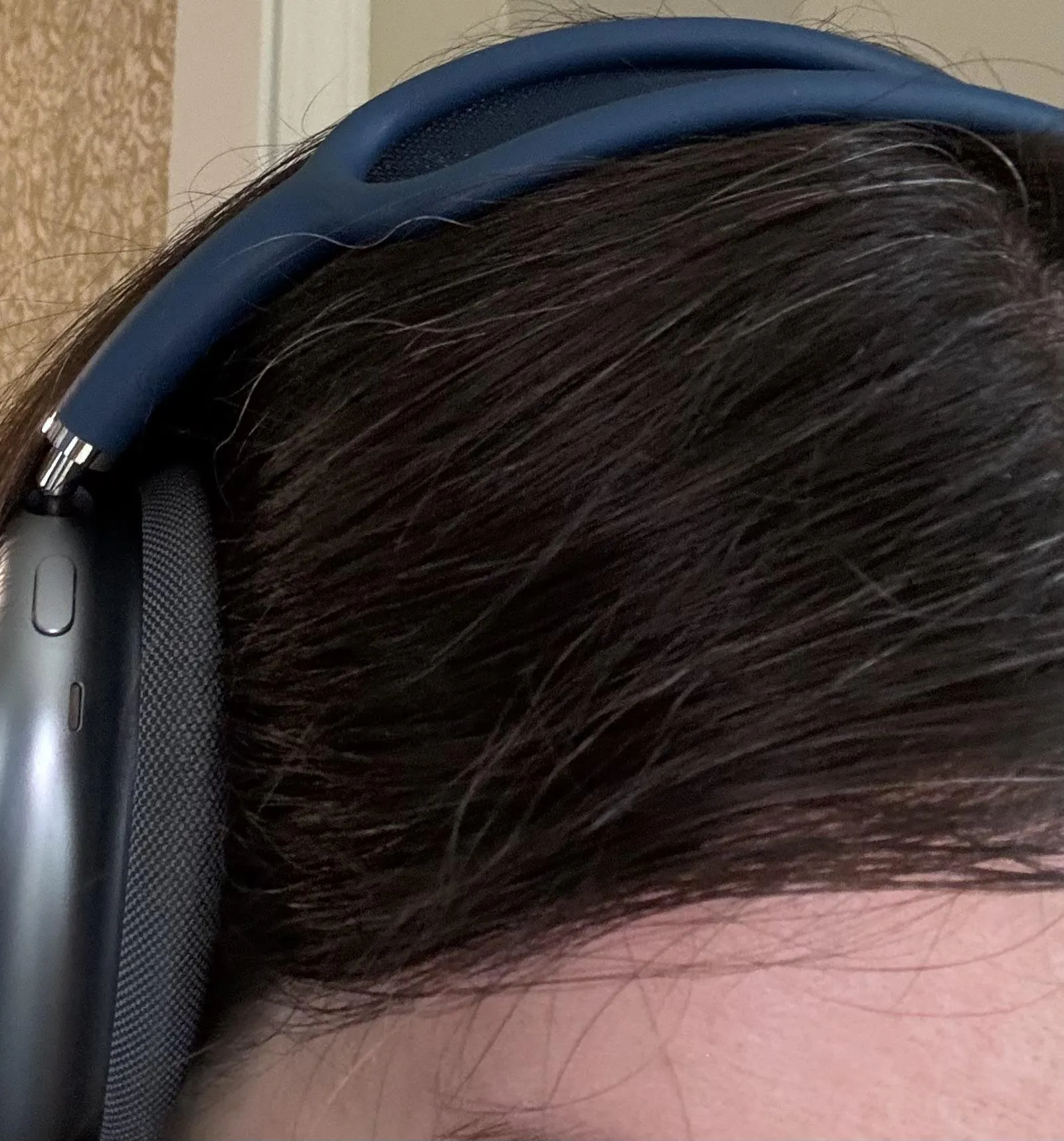 Dealing with sparse gray hair in naturally dark hair?