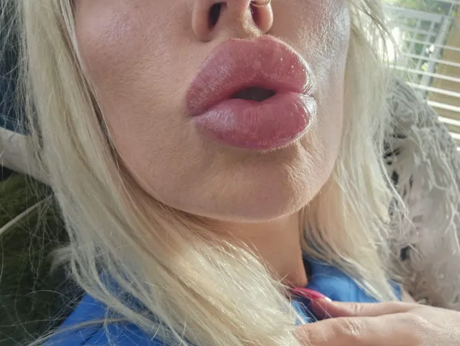 My lips are getting seriously huge. Still bruised from this weeks filler.