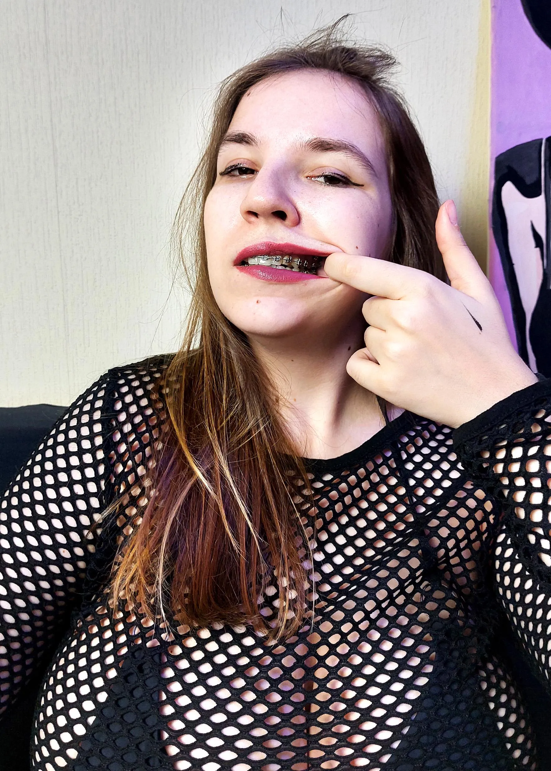 I'm not sure you deserve to see more than just my braces