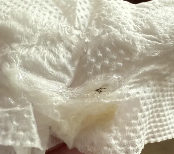 Snot during a four day cold. Can someone please identify the black speck?