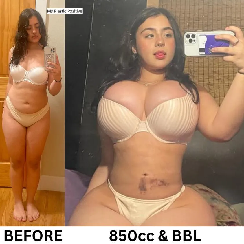 I’m 18 and I can’t wait to go bigger