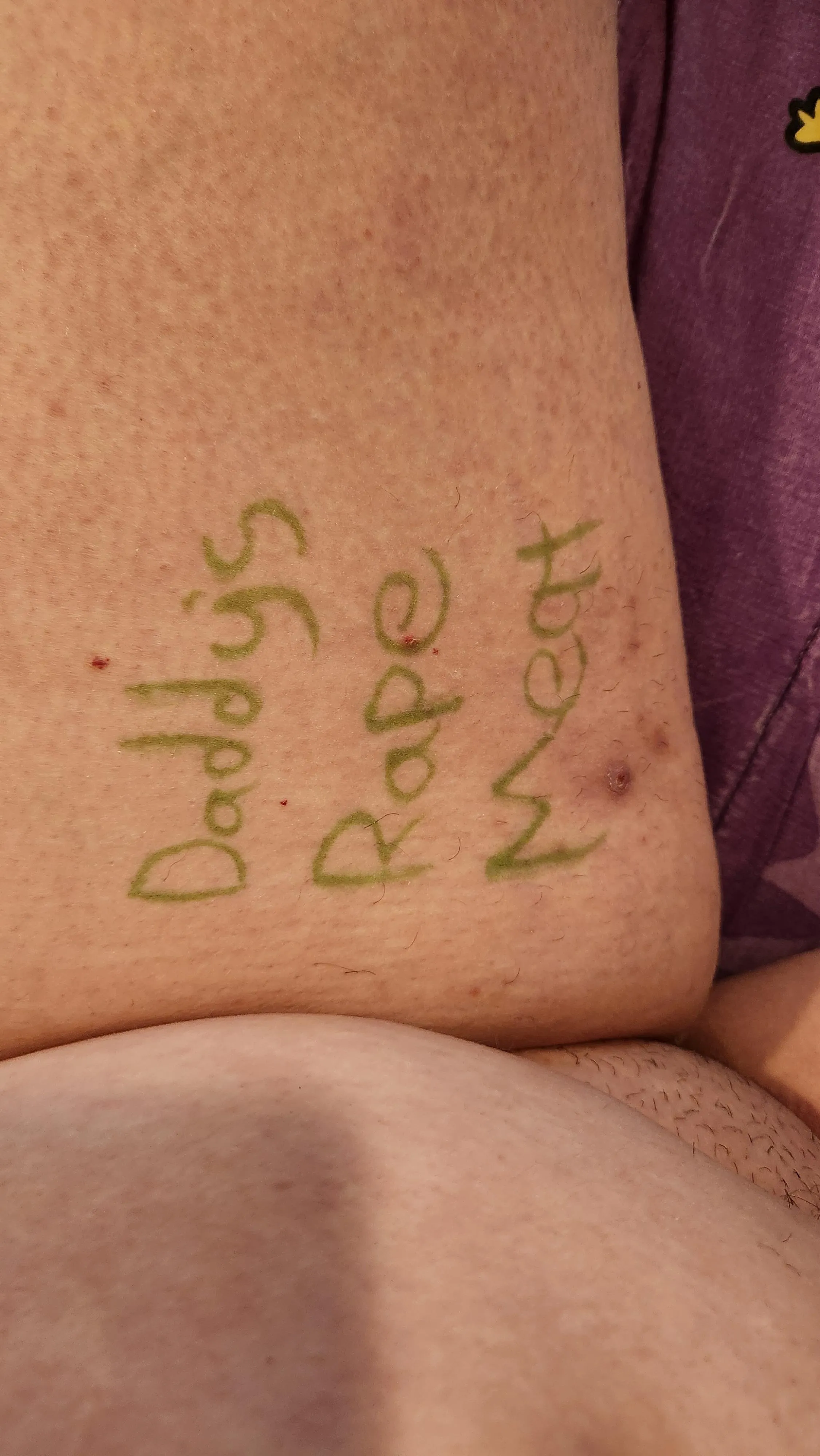 I can't post this on OF so it is going here because everyone needs to know.