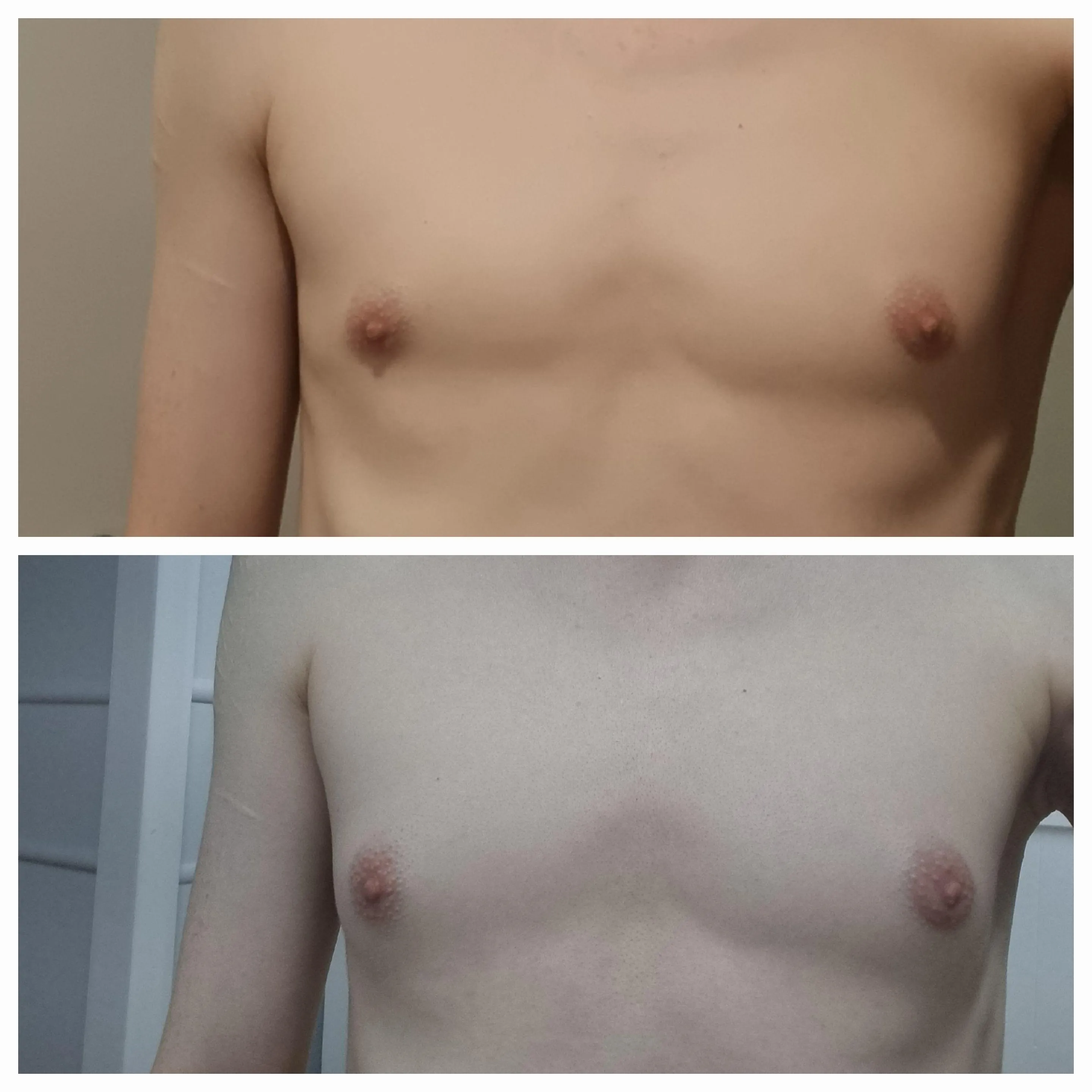 Day 0 hrt to 4 months