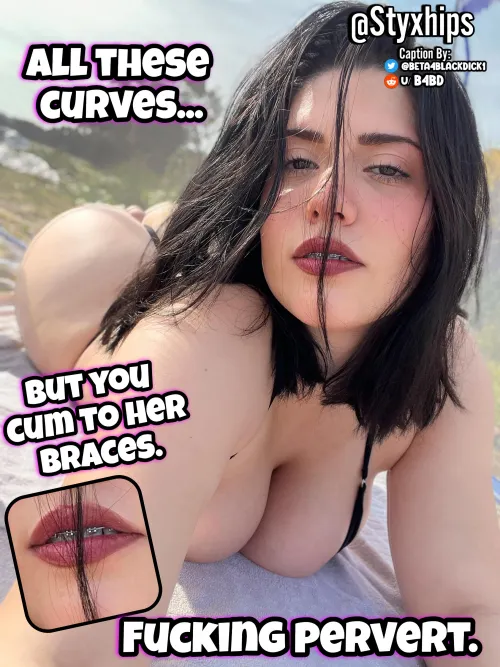 Braces are your trigger aren't they beta?