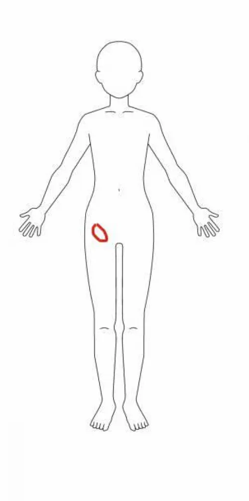 I have a hard round lump on my v line and it only really shows up a couple days before my period or if I haven’t pooped for a few days.