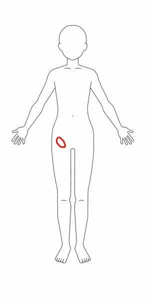 I have a hard round lump on my v line and it only really shows up a couple days before my period or if I haven’t pooped for a few days.