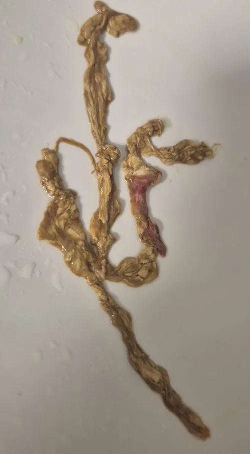 I pulled this out of my butthole. I am really embarassed that i am posting this. Anyone have any idea what this is. Ty!