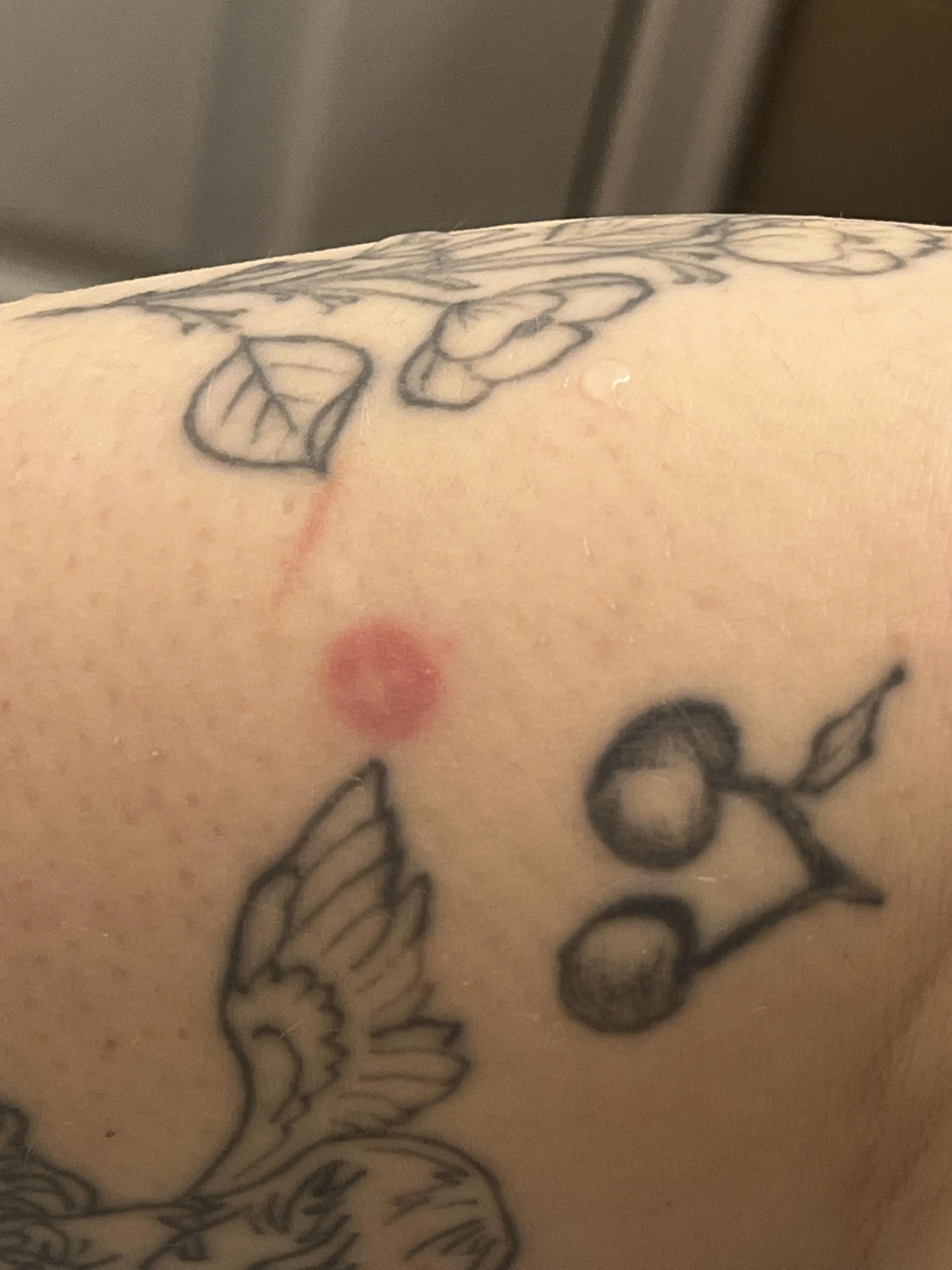 Weird dot on my arm with cross like thing in the middle- No pain … Normal?