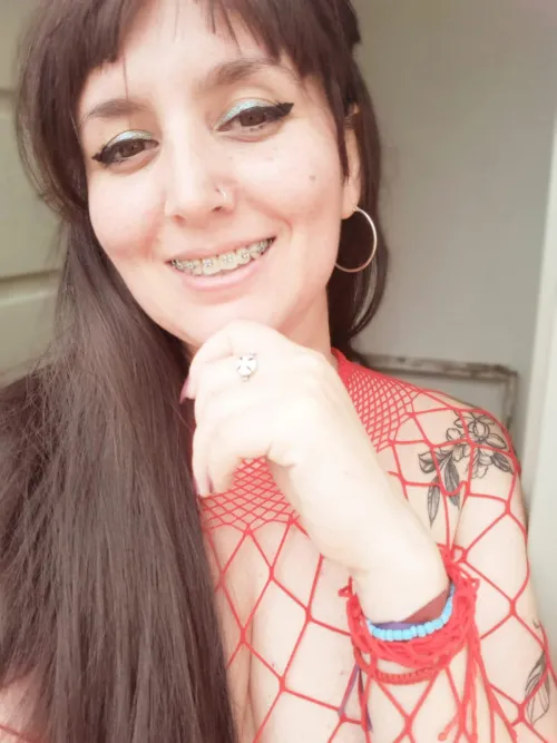 Have you ever kissed a girl with braces?