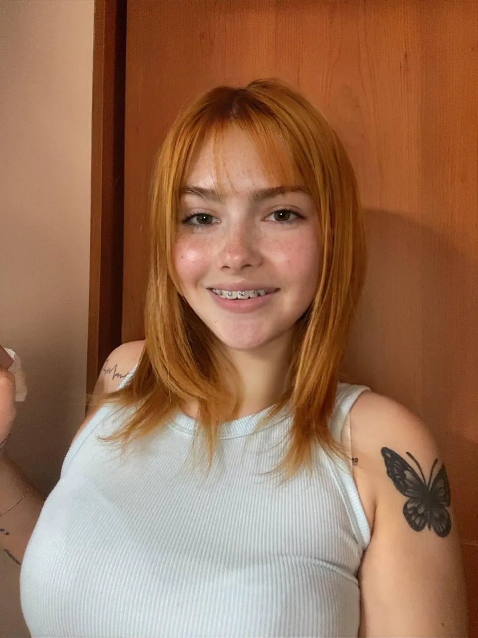 only a few more weeks with these on... cant wait to get them off! f18