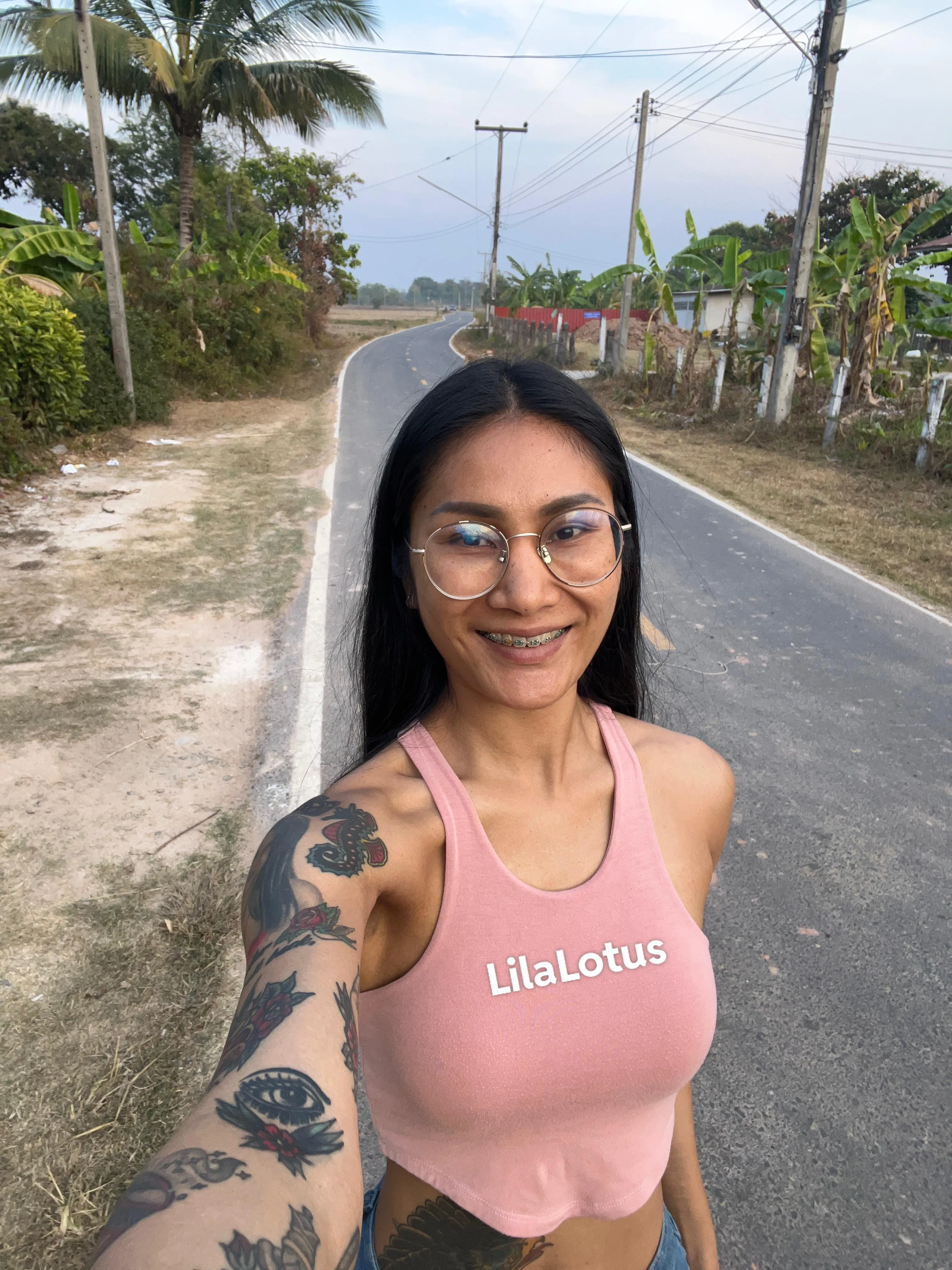 Road to a perfect smile