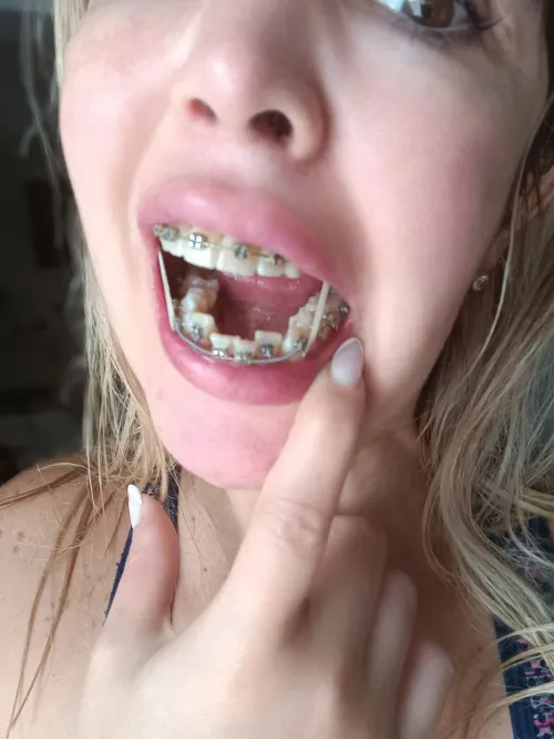 They are getting better, and I'm getting hottest