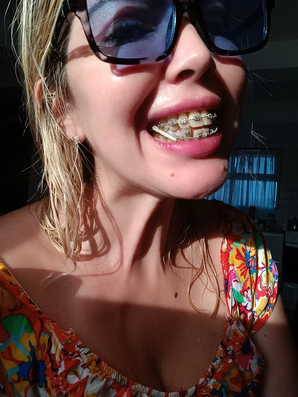 Today it hurts a lot