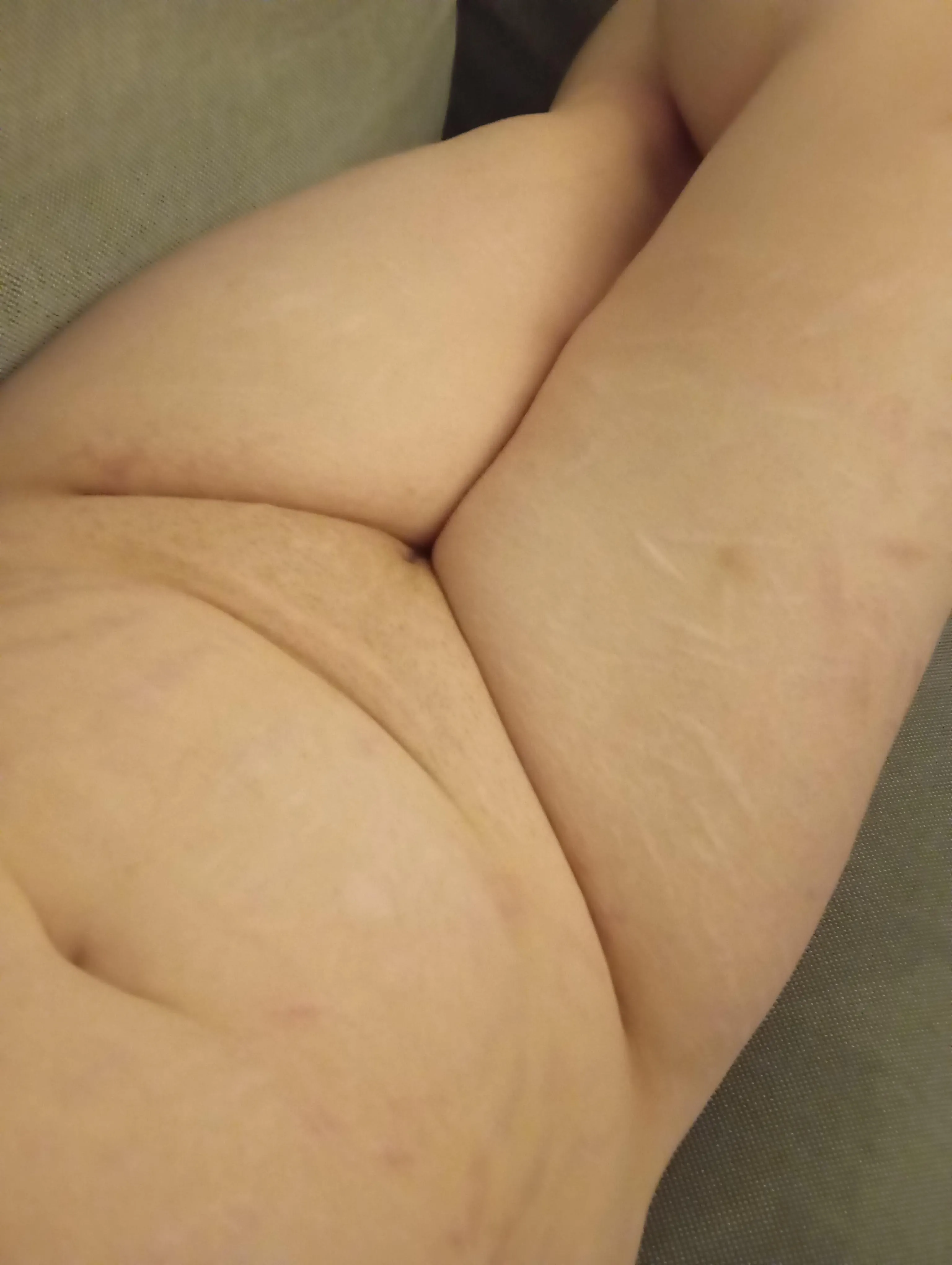 Chubby and scarred ;)