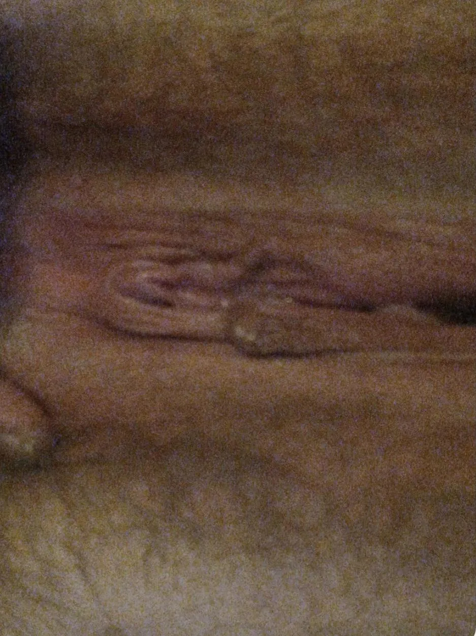 The internet is brutal. Almost 2 years denied. I beg for your mercy.....